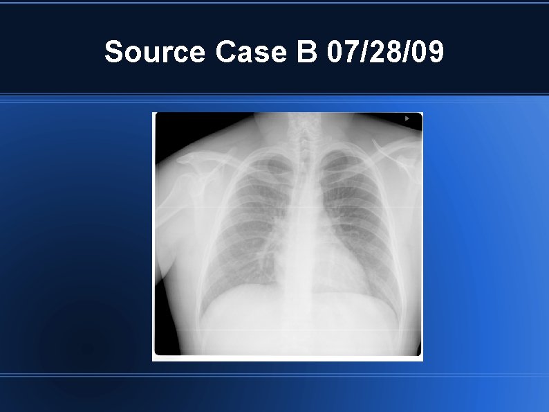 Source Case B 07/28/09 