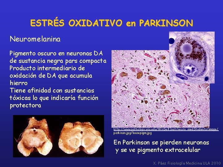 ESTRÉS OXIDATIVO en PARKINSON Neuromelanina Pigmento oscuro en neuronas DA de sustancia negra pars