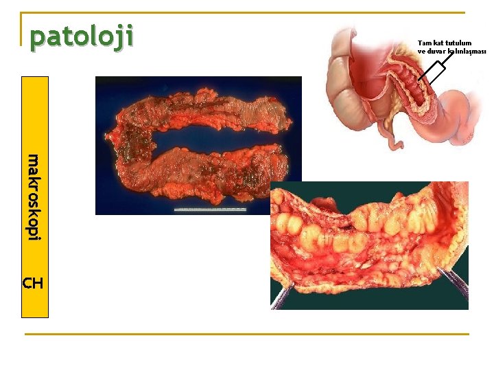 patoloji m a k ro s k o p i CH Tam kat tutulum