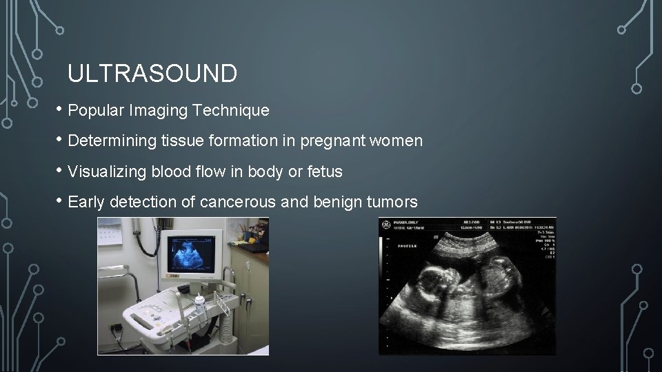 ULTRASOUND • Popular Imaging Technique • Determining tissue formation in pregnant women • Visualizing ULTRASOUND • Popular Imaging Technique • Determining tissue formation in pregnant women • Visualizing