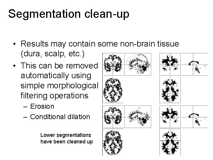 Segmentation clean-up • Results may contain some non-brain tissue (dura, scalp, etc. ) •