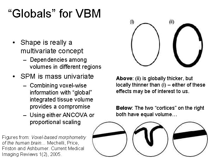 “Globals” for VBM • Shape is really a multivariate concept – Dependencies among volumes