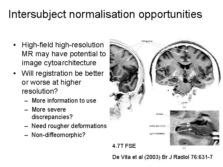 Intersubject normalisation opportunities • High-field high-resolution MR may have potential to image cytoarchitecture •