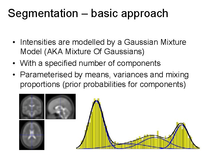 Segmentation – basic approach • Intensities are modelled by a Gaussian Mixture Model (AKA