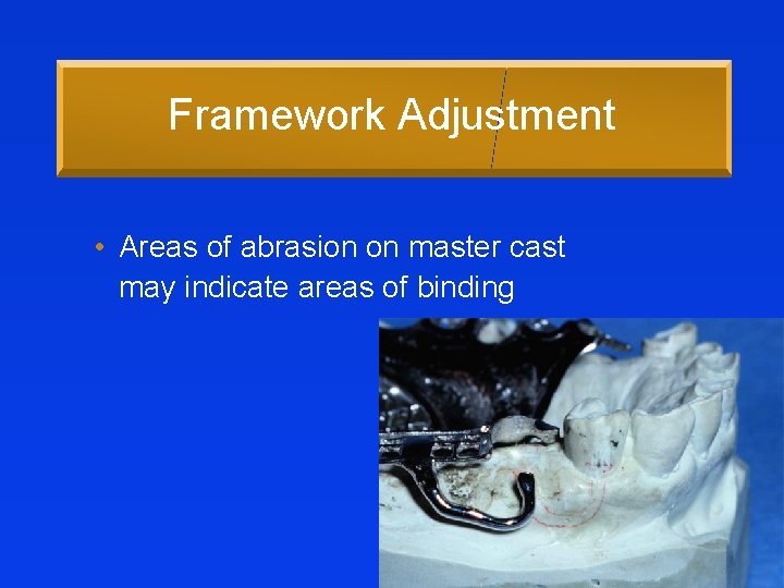 Framework Adjustment • Areas of abrasion on master cast may indicate areas of binding
