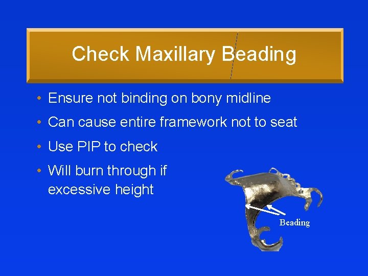Check Maxillary Beading • Ensure not binding on bony midline • Can cause entire