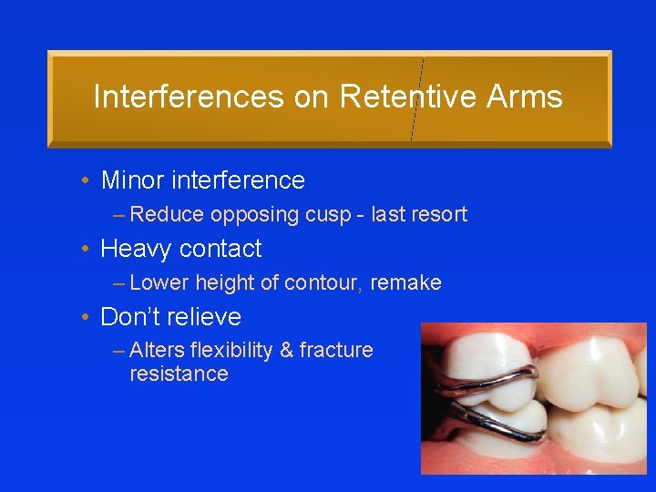 Interferences on Retentive Arms • Minor interference – Reduce opposing cusp - last resort