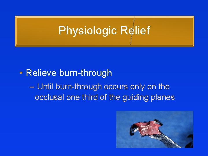 Physiologic Relief • Relieve burn-through – Until burn-through occurs only on the occlusal one