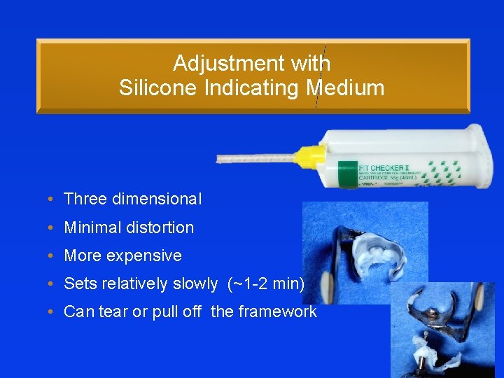 Adjustment with Silicone Indicating Medium • Three dimensional • Minimal distortion • More expensive