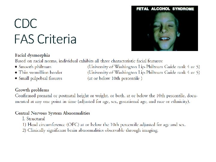 CDC FAS Criteria 