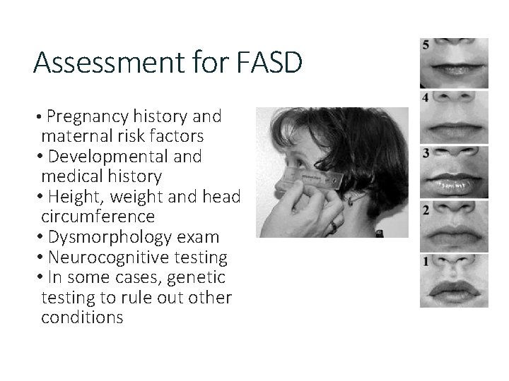 Assessment for FASD • Pregnancy history and maternal risk factors • Developmental and medical