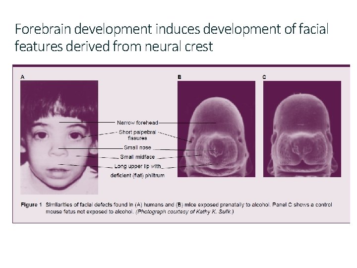 Forebrain development induces development of facial features derived from neural crest 