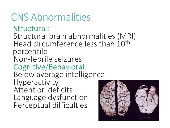 CNS Abnormalities Structural: Structural brain abnormalities (MRI) Head circumference less than 10 th percentile