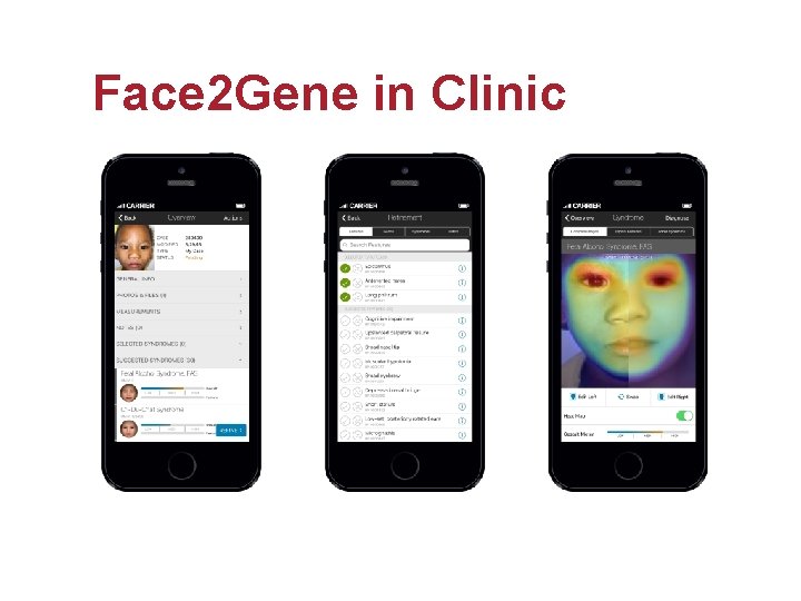 Face 2 Gene in Clinic 