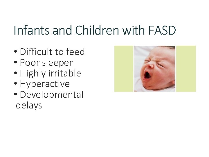 Infants and Children with FASD • Difficult to feed • Poor sleeper • Highly