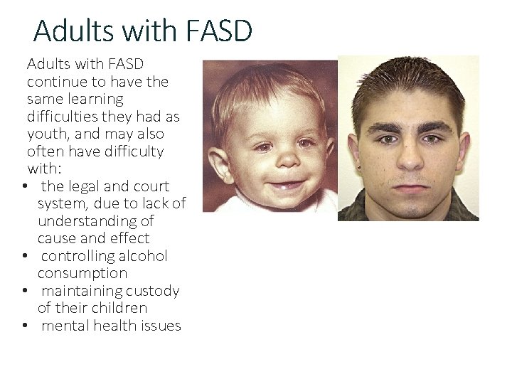 Adults with FASD continue to have the same learning difficulties they had as youth,