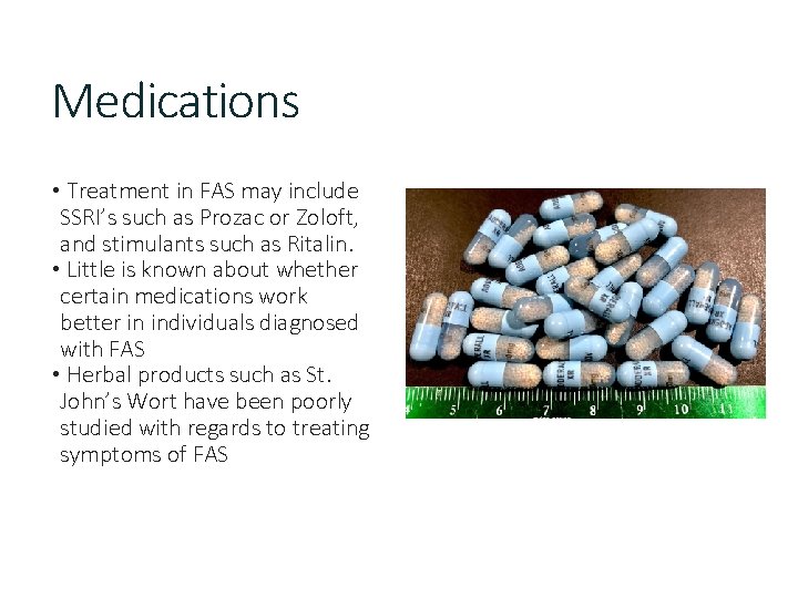 Medications • Treatment in FAS may include SSRI’s such as Prozac or Zoloft, and