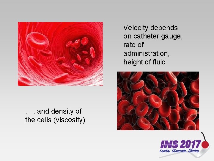 Velocity depends on catheter gauge, rate of administration, height of fluid . . .