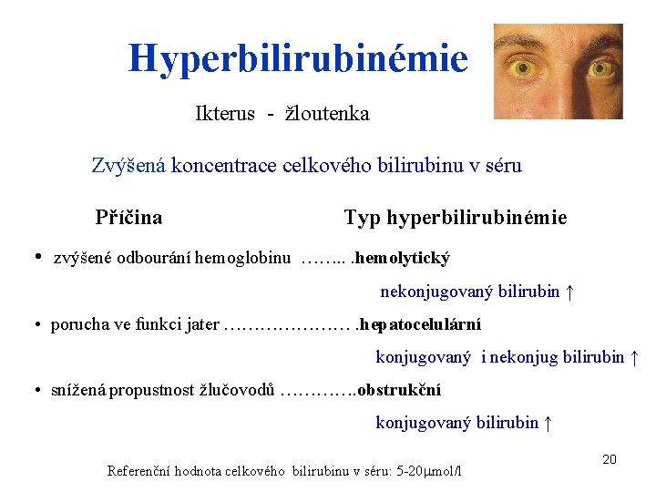 Hyperbilirubinémie Ikterus - žloutenka Zvýšená koncentrace celkového bilirubinu v séru Příčina Typ hyperbilirubinémie •