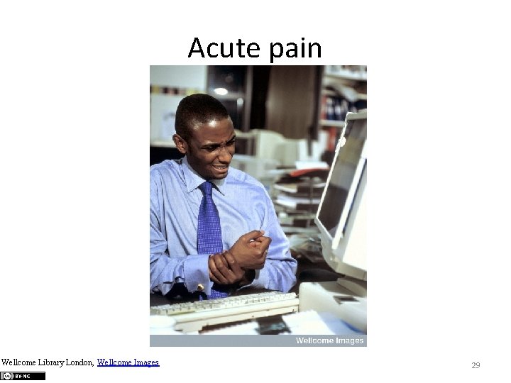Acute pain Wellcome Library London, Wellcome Images 29 