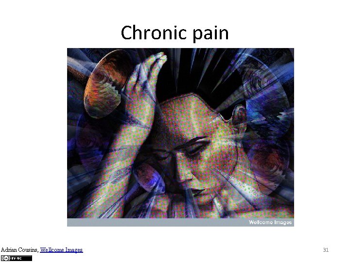 Chronic pain Adrian Cousins, Wellcome Images 31 