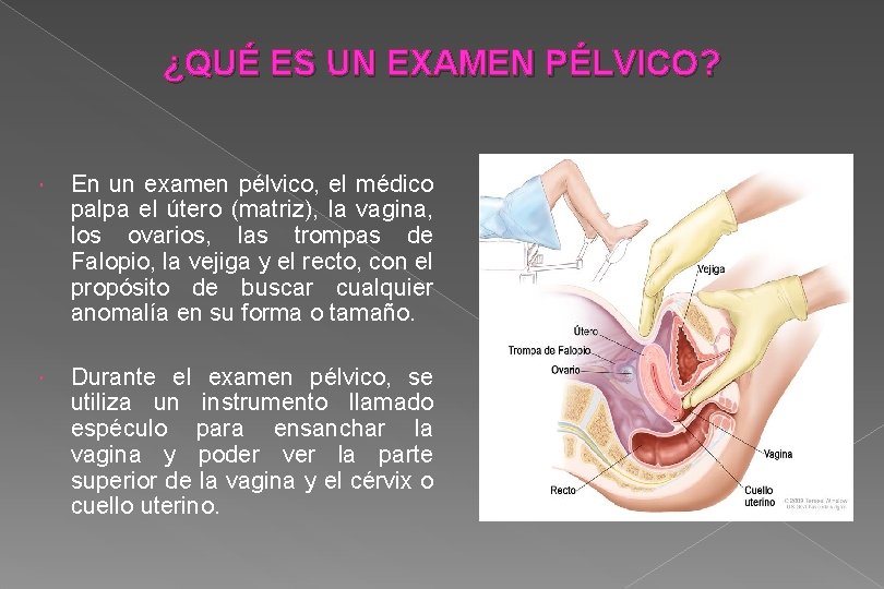 ¿QUÉ ES UN EXAMEN PÉLVICO? En un examen pélvico, el médico palpa el útero