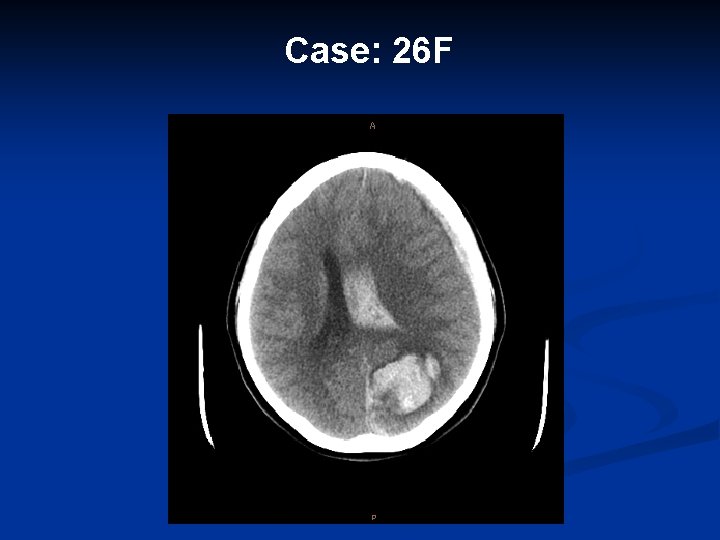 Case: 26 F 