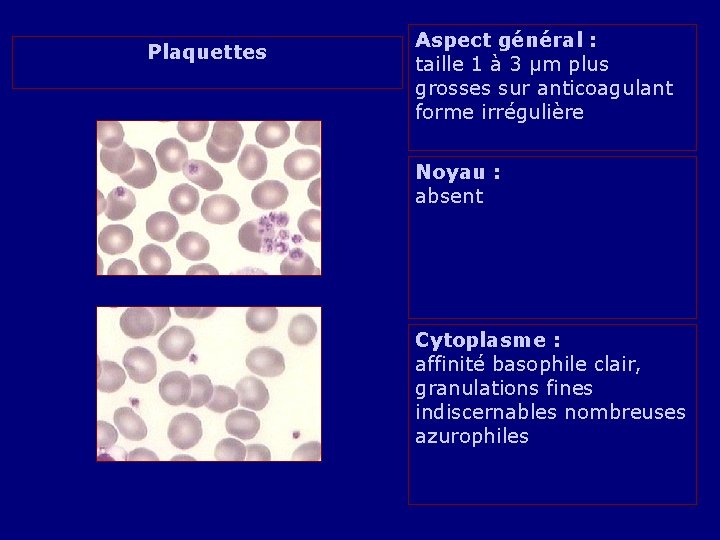 Plaquettes Aspect général : taille 1 à 3 µm plus grosses sur anticoagulant forme