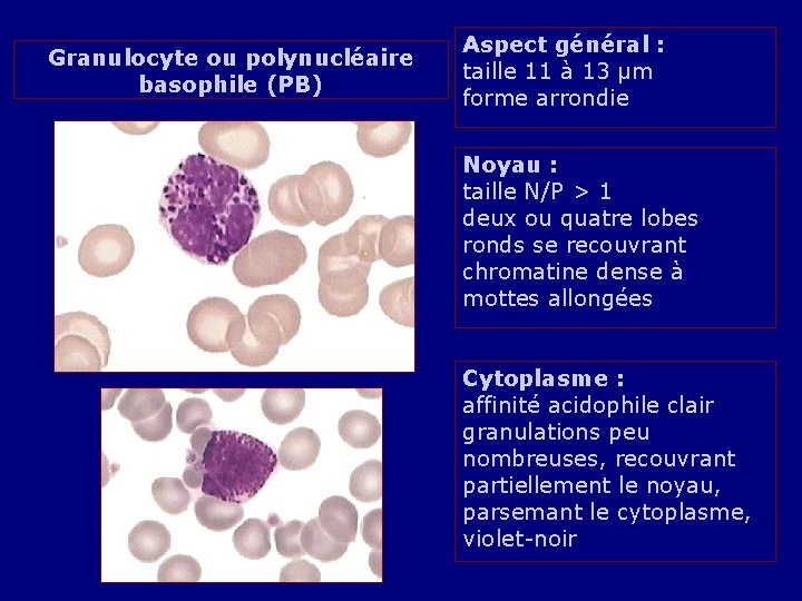 Granulocyte ou polynucléaire basophile (PB) Aspect général : taille 11 à 13 µm forme