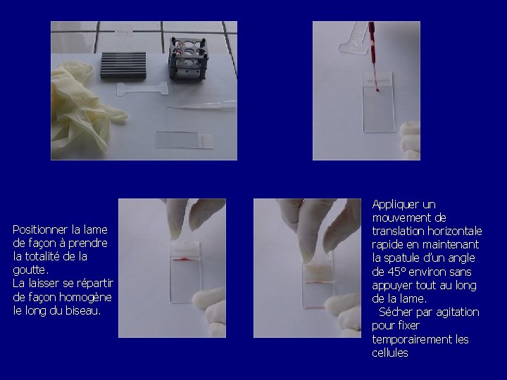 Positionner la lame de façon à prendre la totalité de la goutte. La laisser