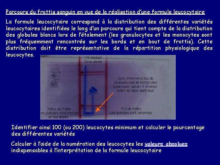 Parcours du frottis sanguin en vue de la réalisation d’une formule leucocytaire La formule