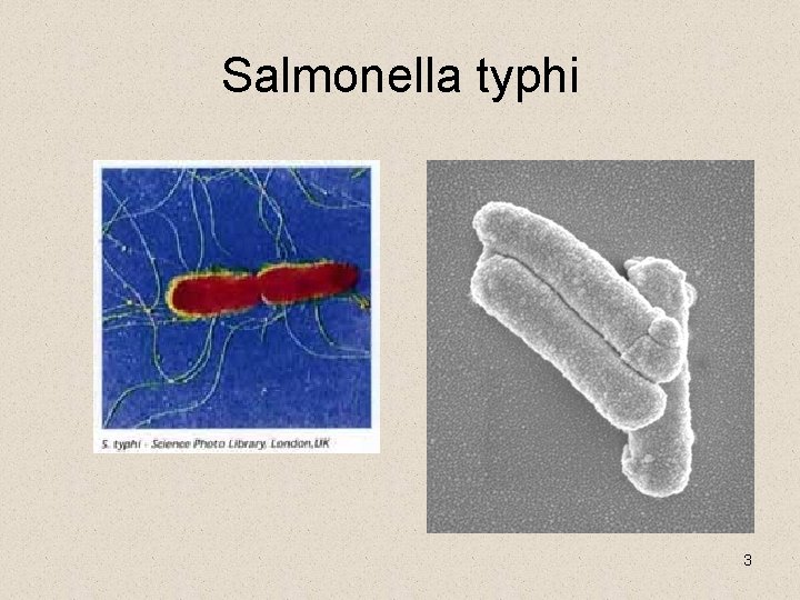Salmonella typhi 3 