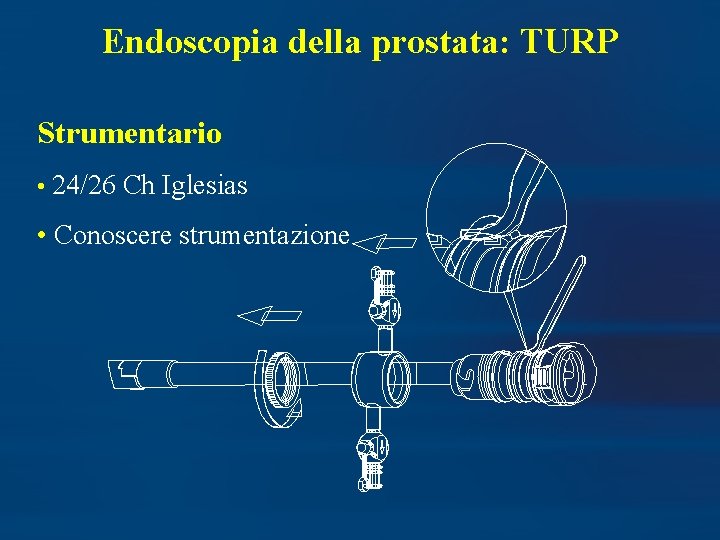 Endoscopia della prostata: TURP Strumentario • 24/26 Ch Iglesias • Conoscere strumentazione 