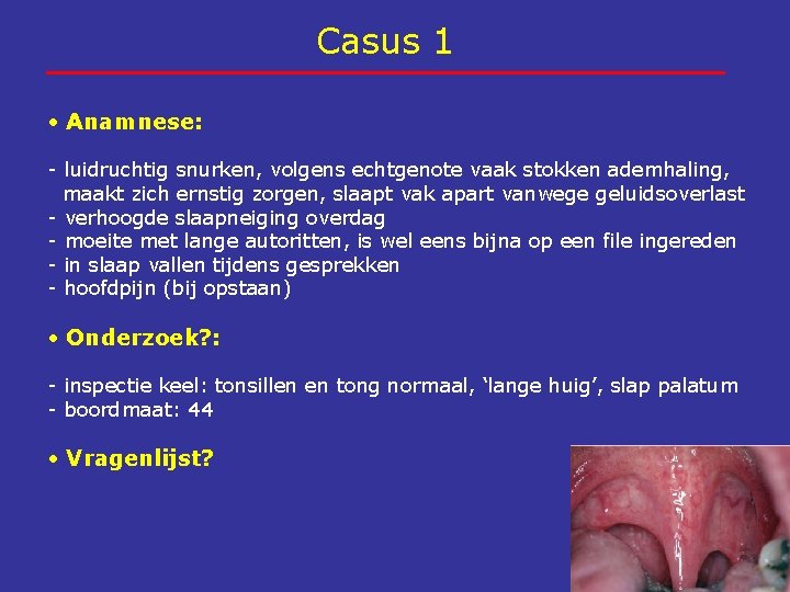 Casus 1 Anamnese: - luidruchtig snurken, volgens echtgenote vaak stokken ademhaling, maakt zich ernstig