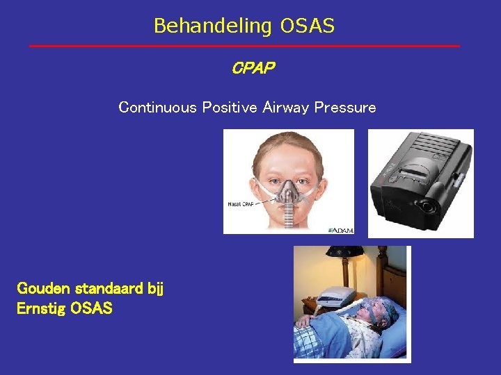 Behandeling OSAS CPAP Continuous Positive Airway Pressure Gouden standaard bij Ernstig OSAS 