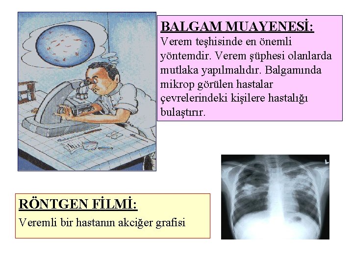 BALGAM MUAYENESİ: Verem teşhisinde en önemli yöntemdir. Verem şüphesi olanlarda mutlaka yapılmalıdır. Balgamında mikrop