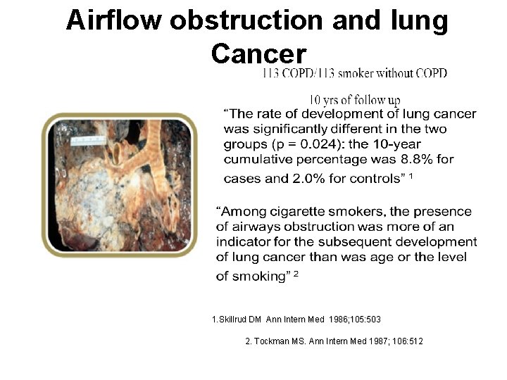 Airflow obstruction and lung Cancer 1. Skillrud DM Ann Intern Med 1986; 105: 503