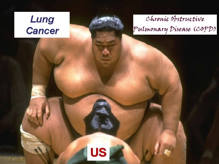 Lung Cancer US 