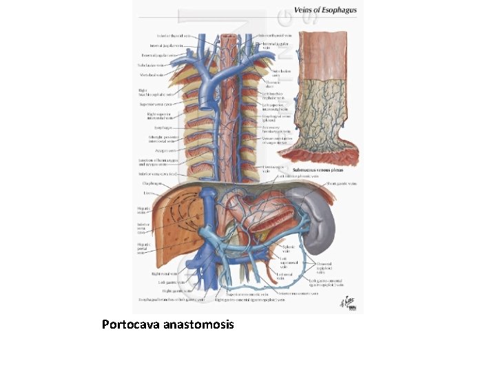 Portocava anastomosis 