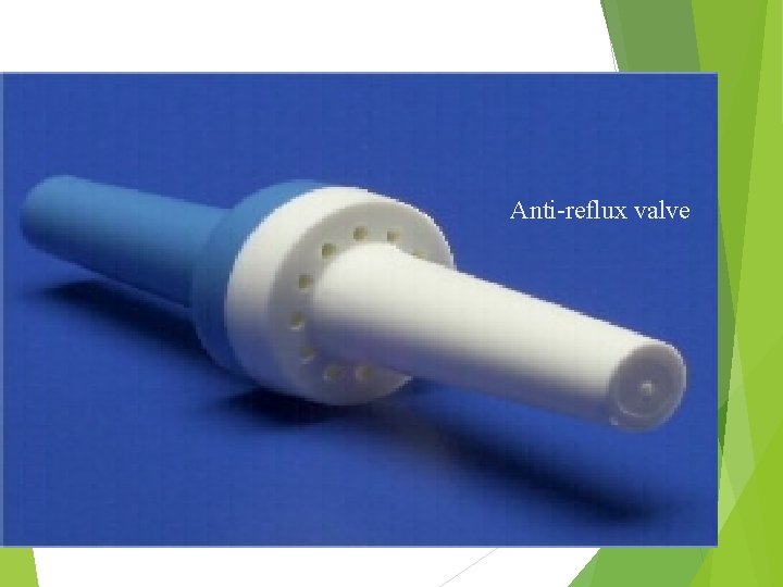 Anti-reflux valve 35 