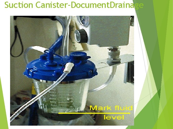Suction Canister-Document. Drainage 37 Suction Canister-Document. Drainage 37