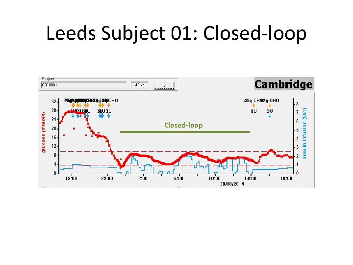 Leeds Subject 01: Closed-loop 