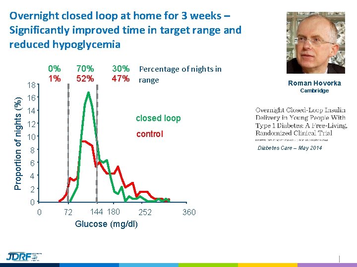 Overnight closed loop at home for 3 weeks – Significantly improved time in target