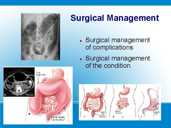 Surgical Management Surgical management of complications Surgical management of the condition 