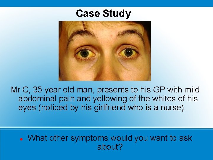 Case Study Mr C, 35 year old man, presents to his GP with mild