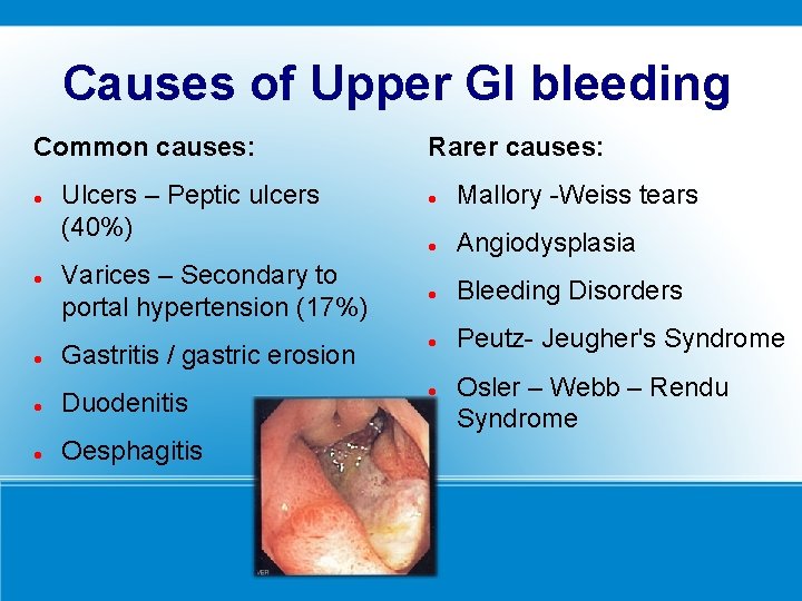 Causes of Upper GI bleeding Common causes: Mallory -Weiss tears Angiodysplasia Bleeding Disorders Gastritis