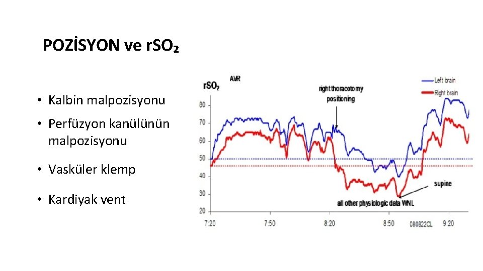 POZİSYON ve r. SO₂ • Kalbin malpozisyonu • Perfüzyon kanülünün malpozisyonu • Vasküler klemp