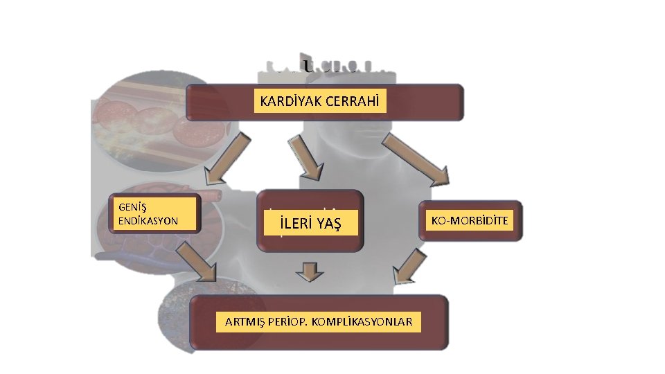 KARDİYAK CERRAHİ GENİŞ ENDİKASYON İLERİ YAŞ ARTMIŞ PERİOP. KOMPLİKASYONLAR KO-MORBİDİTE 