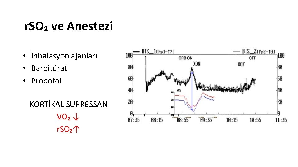 r. SO₂ ve Anestezi • İnhalasyon ajanları • Barbitürat • Propofol KORTİKAL SUPRESSAN VO₂