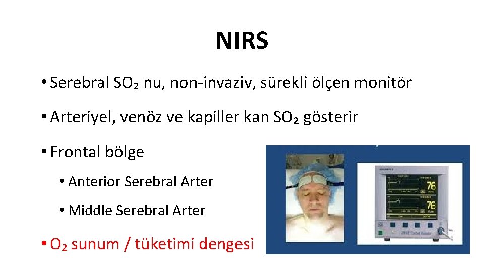 NIRS • Serebral SO₂ nu, non-invaziv, sürekli ölçen monitör • Arteriyel, venöz ve kapiller